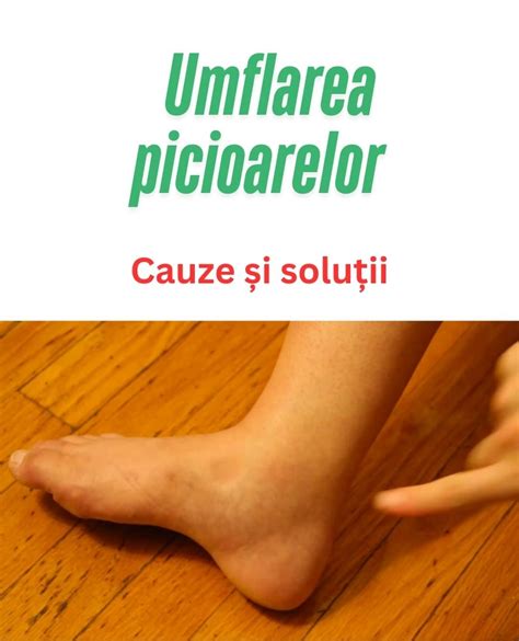 Ilustrație a diferitelor cauze posibile ale disfuncției hipotalamice