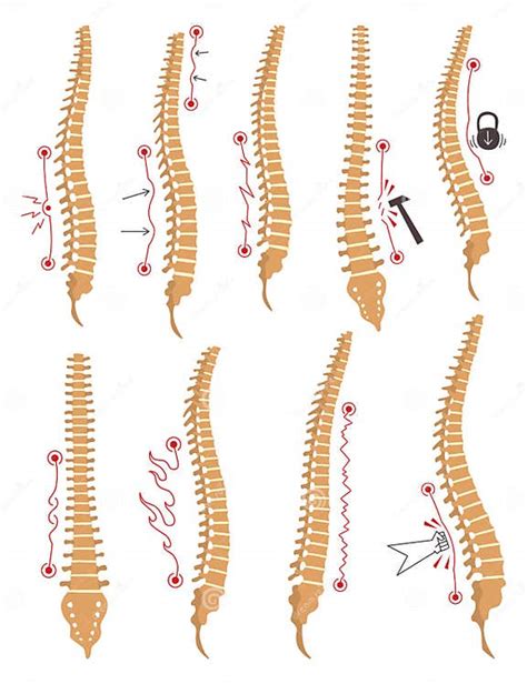 Ilustrații medicale pentru diverse deformări ale membrelor și coloanei vertebrale la copii