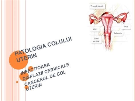 Ilustrație a placentă praevia, arătând acoperirea colului uterin