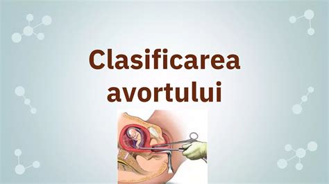 infografic cu etapele avortului medicamentos și chirurgical