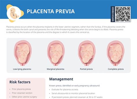 diagramă medicală explicând placenta previa