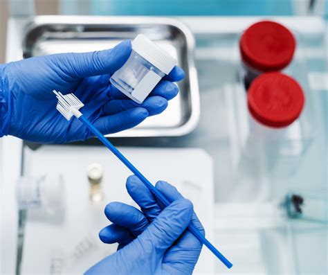 Ilustrație a procedurii de recoltare a probei pentru testul Papanicolau