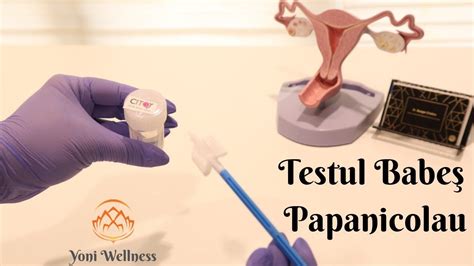 Diagramă comparativă a diferitelor tipuri de rezultate ale testului Papanicolau și a pașilor următori recomandați