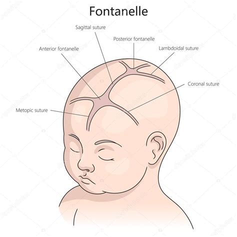 Ilustratie medicala care arata o fontanela normala, una bombata si una infundata