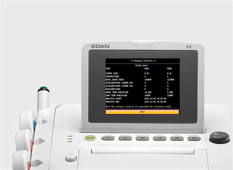 ecran cu rezultate CTG