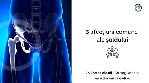 Ilustrație anatomică a șoldului, evidențiind luxația congenitală