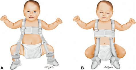 ham Pavlik aplicat unui bebelus