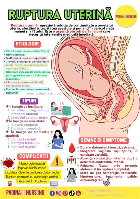 Ilustrație: Aspectul pielii gravidei la 23 de săptămâni, incluzând vergeturi, linia neagră și masca de sarcină.