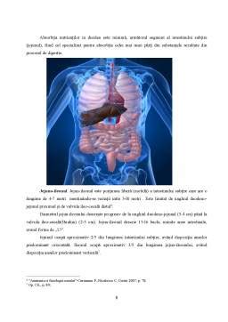 Imagine radiologică a unui abdomen cu semne de ocluzie intestinală.