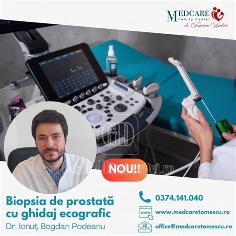 Ilustrație a procedurii de biopsie de vilozități coriale cu ghidaj ecografic