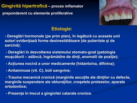 Infografic explicativ despre cauzele arsurilor în sarcină: modificări hormonale, presiunea uterului, alimentație