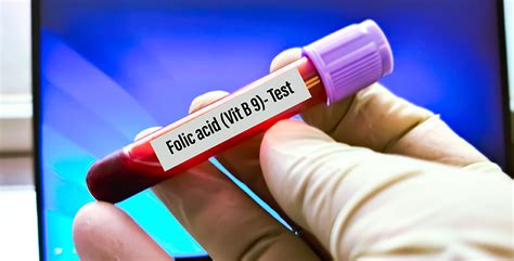 ilustrație care prezintă semnele și simptomele deficitului de acid folic