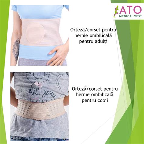 Diagramă explicativă a aplicării corecte a corsetului abdominal pentru hernie ombilicală, inclusiv poziționarea pelotei.