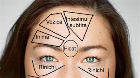 Ilustrație a feței unei femei, cu accent pe zona mandibulară și periorală, unde apar predominant leziunile specifice acneei hormonale.