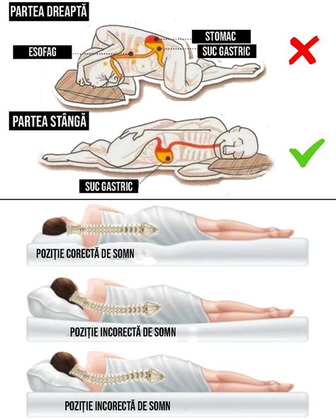 Ilustrație comparativă a pozițiilor de somn recomandate (pe partea stângă, cu perne) și nerecomandate (pe spate).