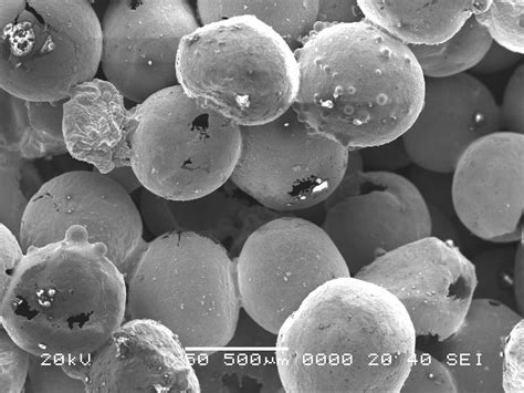 Microscopie electronică a plăcii bacteriene, evidențiind diversitatea microorganismelor.