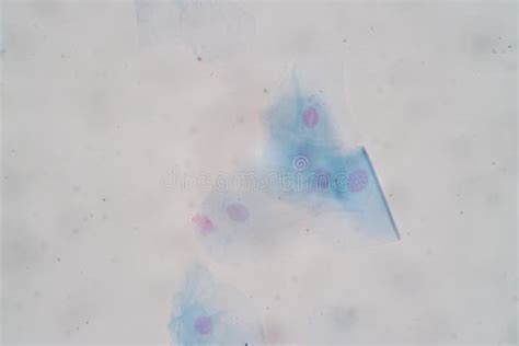 Imagine microscopică a celulelor epiteliale vaginale acoperite de bacterii (