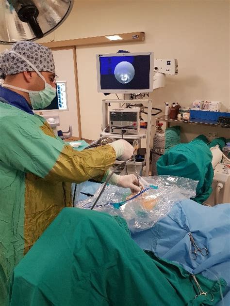 Imagine endoscopică din timpul disecției herniei ombilicale.