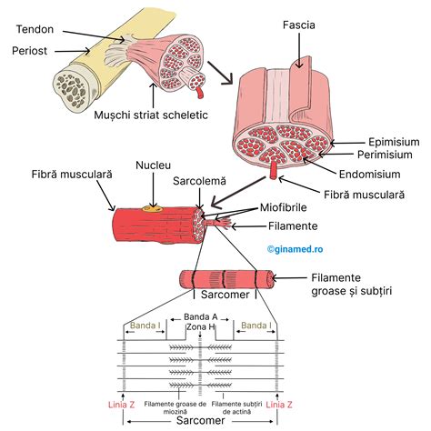diagramă ilustrând diferența dintre un perete abdominal sănătos și unul cu hernie incizională
