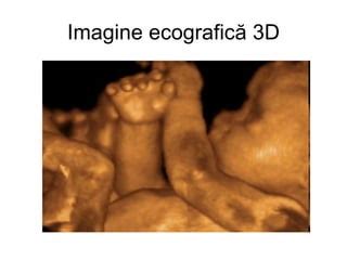 Imagine ecografică 3D a organelor pelvine