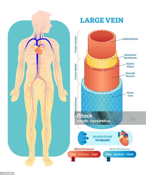 Ilustrație medicală cu o secțiune transversală a abdomenului după cezariană, evidențiind cicatricea