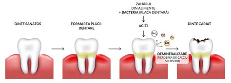Comparație vizuală între aspectul dinților afectați de demineralizare și cei afectați de fluoroza
