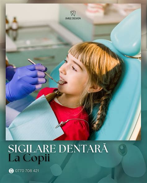 Infografic: Pașii procedurii de sigilare dentară