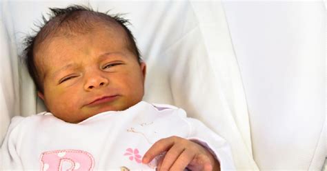 Infografic comparativ între icterul fiziologic și icterul patologic, evidențiind cauzele, momentul apariției și caracteristicile principale.