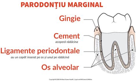 Diagramă explicativă a cauzelor și efectelor gingivitei în sarcină