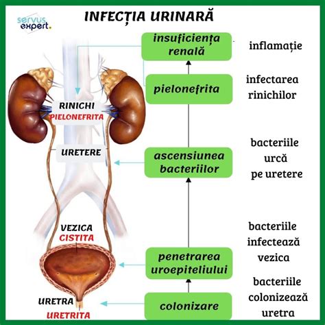 infecție urinară - bacteriile din tractul urinar
