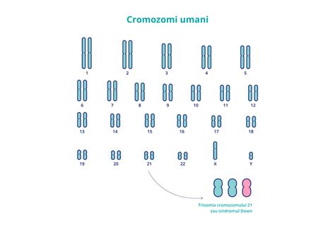 ilustrație a cromozomului 21 suplimentar