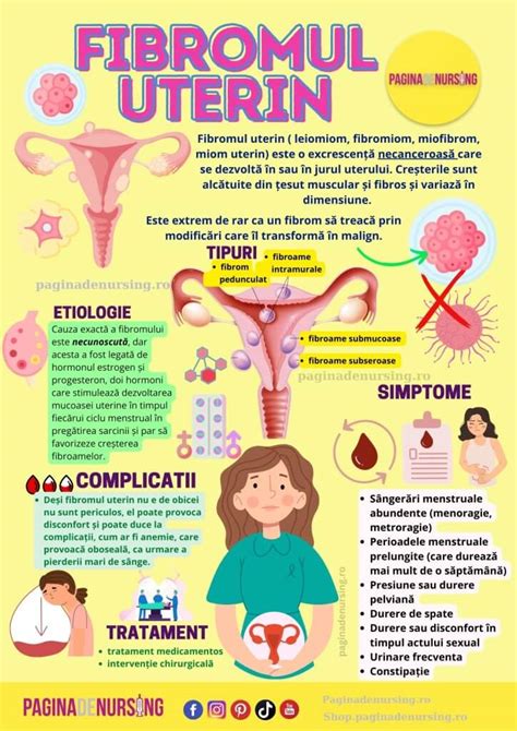 Ilustrație a unui fibrom uterin care afectează poziția fătului