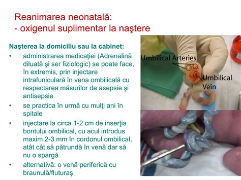 Diagramă explicativă a procesului de vindecare a bontului ombilical.