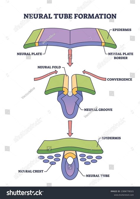 schemă a tubului neural și a defectelor de tub neural