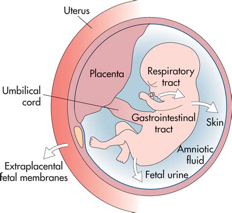 Diagramă explicativă a mecanismului emboliei cu fluid amniotic