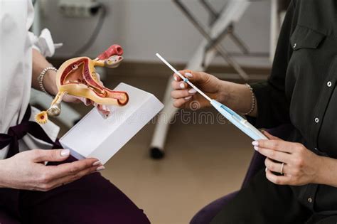 ilustrație schematică a procedurii de montare a unui dispozitiv intrauterin