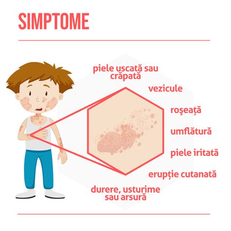 Ilustrație a unui copil cu erupție cutanată specifică dermatomiozitei