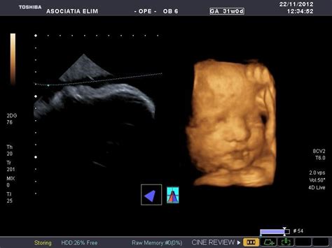Imagine cu ecografie fetala detaliată