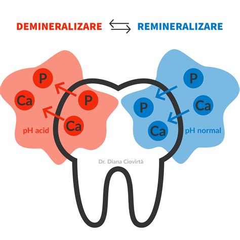 Infografic comparând smalțul sănătos cu smalțul demineralizat, evidențiind pierderea de minerale.