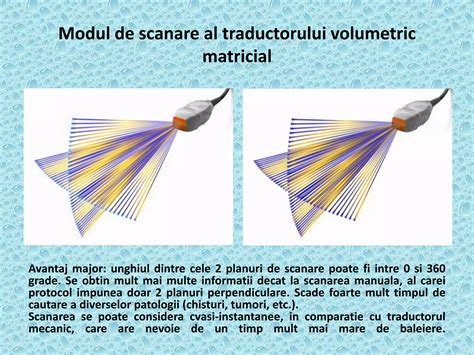 Diagramă explicativă a poziționării traductorului cu ultrasunete pe abdomenul mamei