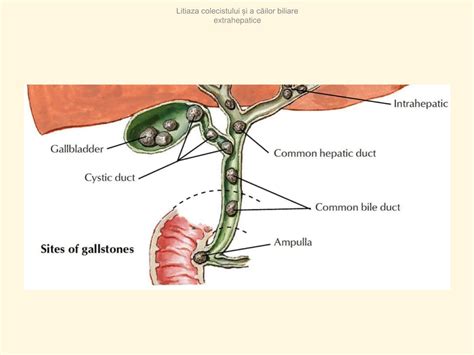 Ilustrație anatomică a vezicii biliare și a căilor biliare