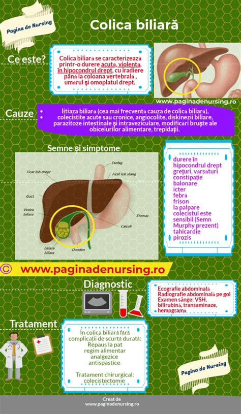 Infografic cu zonele de iradiere a durerii în colica biliară