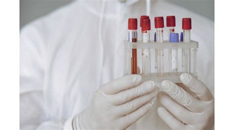 Ilustrație cu diverse tipuri de probe biologice utilizate în testele ADN